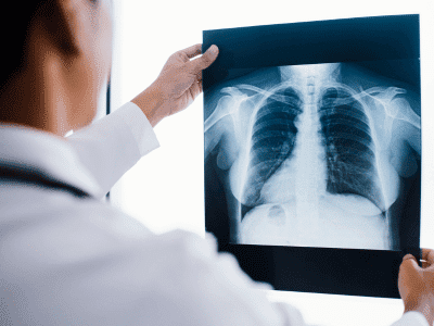 Raio - X Tórax